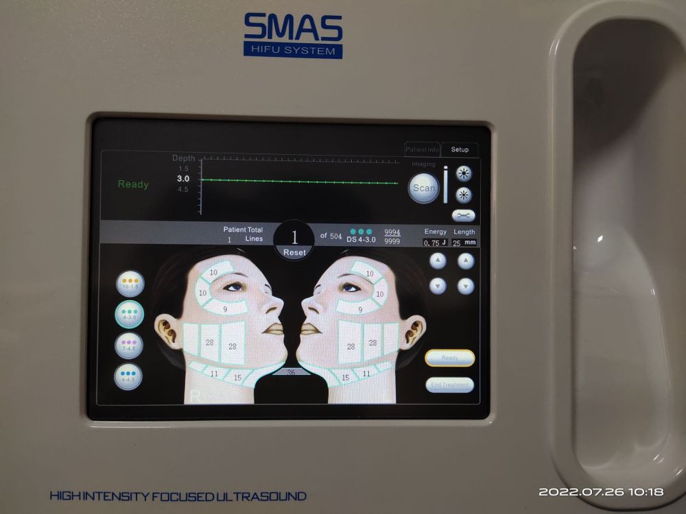 Only Machine Body Hifu Machine ( not include the handle and hifu cartridges )