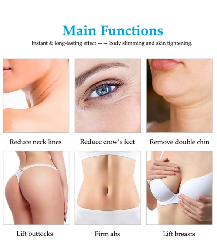 Comfortable treatment 5D ice hifu vmax smas face lifting frozen hi fu machine with skin cooling 2 in 1