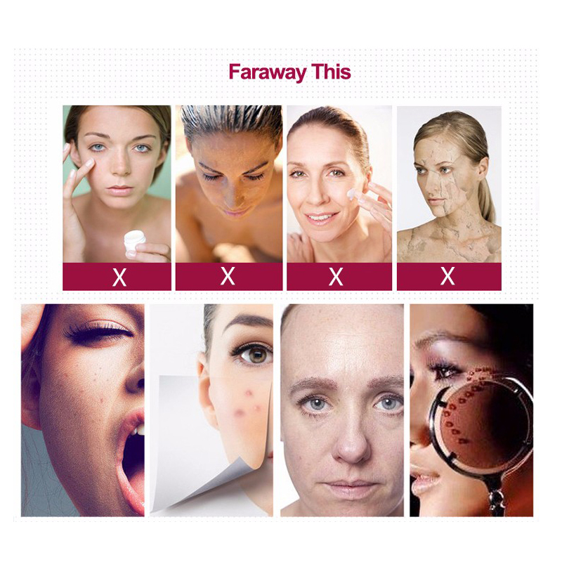 Price for 25pcs 12/36/42/nano Replacement Microneedle Cartridges Tips Head for Derma Pen Dr.pen A1 Skin Care Rejuvenation