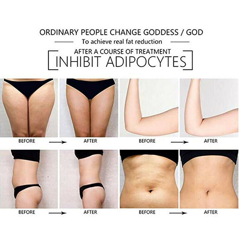 6 IN 1 40K Ultrasonic Cavitation Lipo Laser Liposuction Weight Loss Machines Radio Frequency Skin Tightening Vacumm Slimming Machine