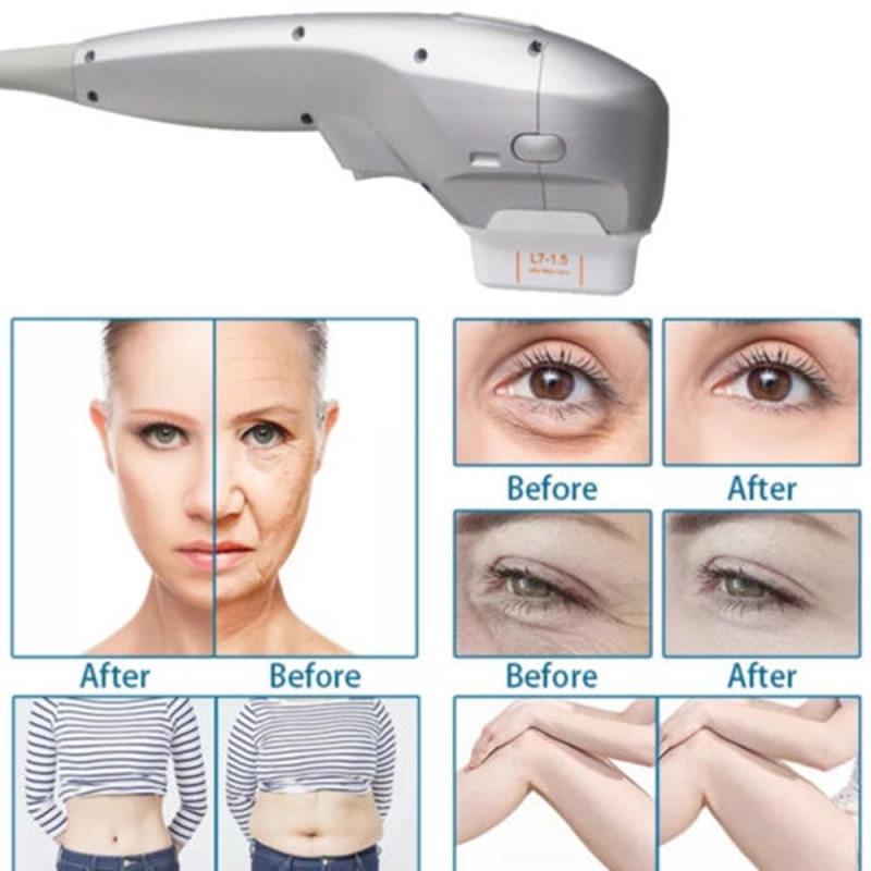 Professional Hifu 7D Focused Ultrasound Newest 7D Hifu Body And Face Slimming Machine 7D Hifu For Winkle Removal