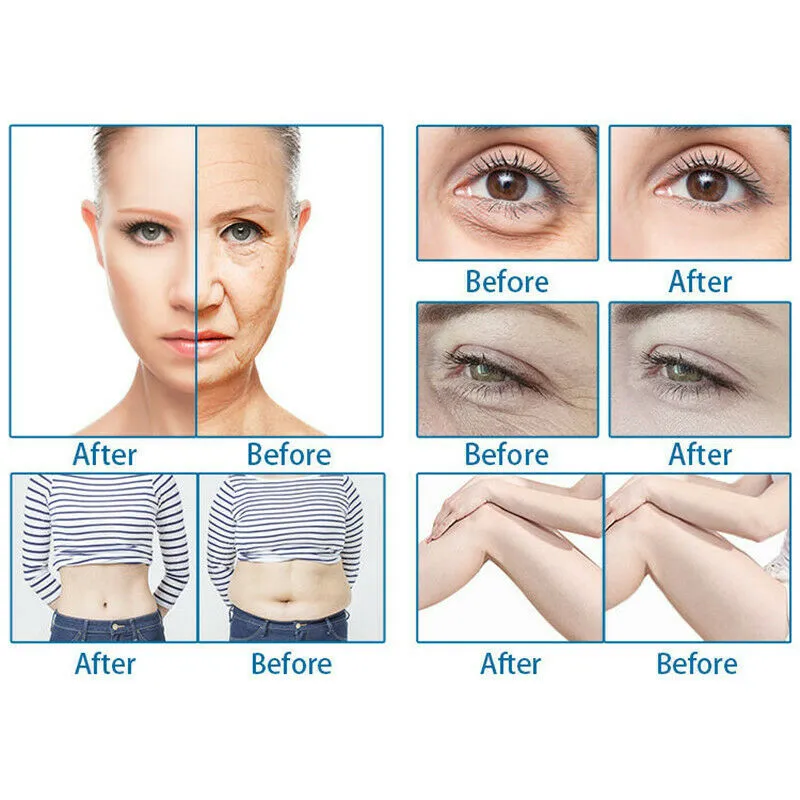 Ultrasonic 7D Hifu Machine with 7pcs Cartridges Face Skin Tightening Body Slimming Wrinkle Removal Skin Care Rejuvenation