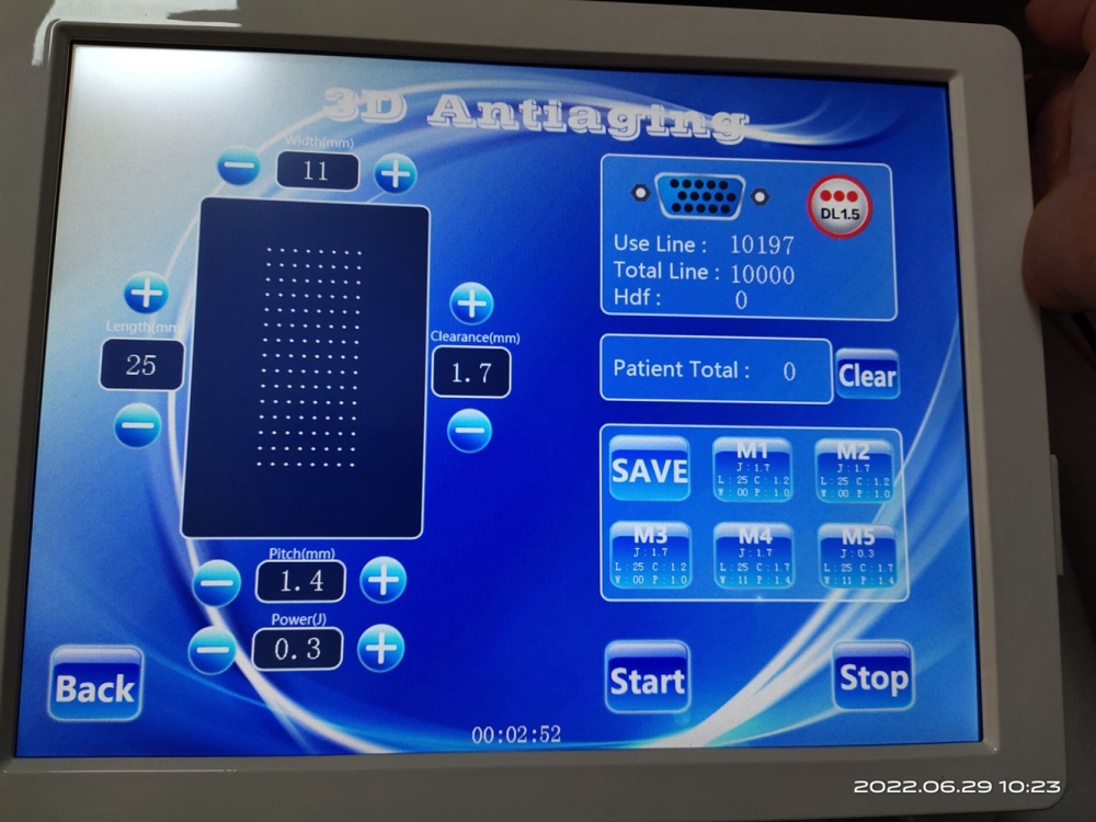 Portable 3D 4D HIFU Machine Face Lifting Wrinkle Removal Facial Machine Fat Reduction Body Slimming HIFU Machine