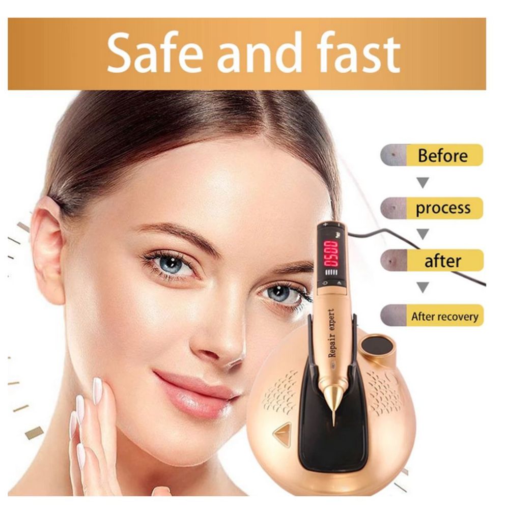 Portable Cold Plasma Ozone Jet Pen Skin Care Acne Treatment Removal Beauty Machine