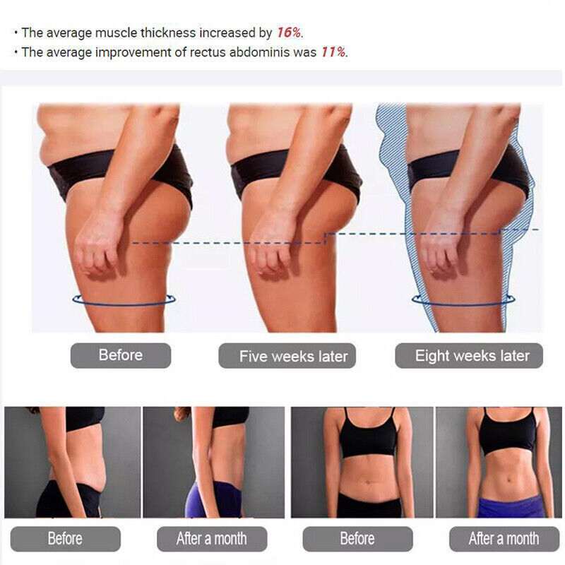 Professional EMslim Neo RF Muscle Building Stimulation Machine EMS Fat Removal Body Sculpting