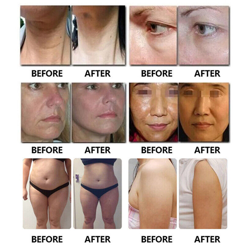 Professional 2in1 Ultrasonic Hifu Machine SMAS Face Skin Lifting Vaginal Tightening Rejuvenation Body Slimming Each Cartridge 10000 Shots