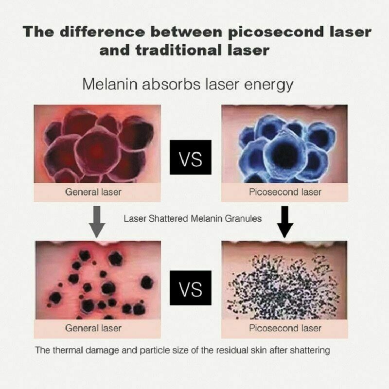 Professional Picosecond Pigment Laser Tattoo Removal Machine Pico Laser Skin Rejuvenation with 755nm + 1064nm + 532nm + 1320nm Head