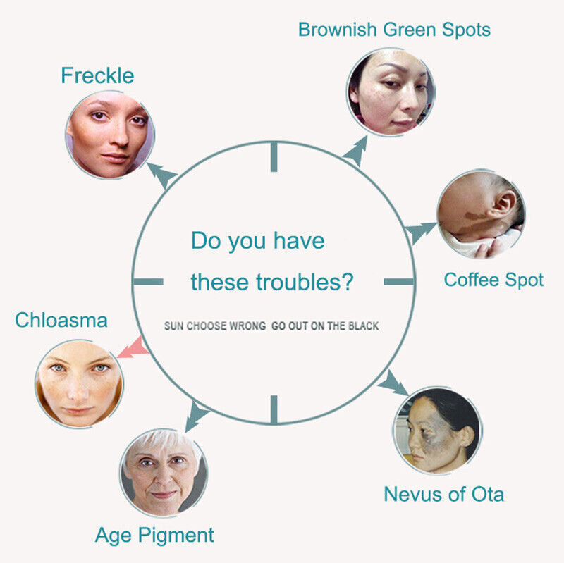 Picosecond Laser Tattoo Removal Machine Picosure Laser Skin Rejuvenation Pigment with 755nm+1064nm+532nm+1320nm