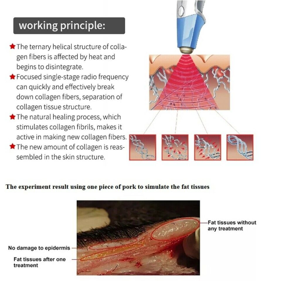 2IN1 Ultrasound RF Radio Frequency BTL Device Skin Tightening Wrinkle Remover Body Slimming Machine