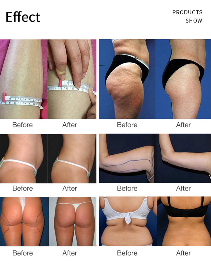 80k Cavitation Machine,Multifunction 6 in 1 80K Body Beauty Machine,for Wrinkle Remove,Professional Body Shaping Device for Belly Waist Legs Skin Firming