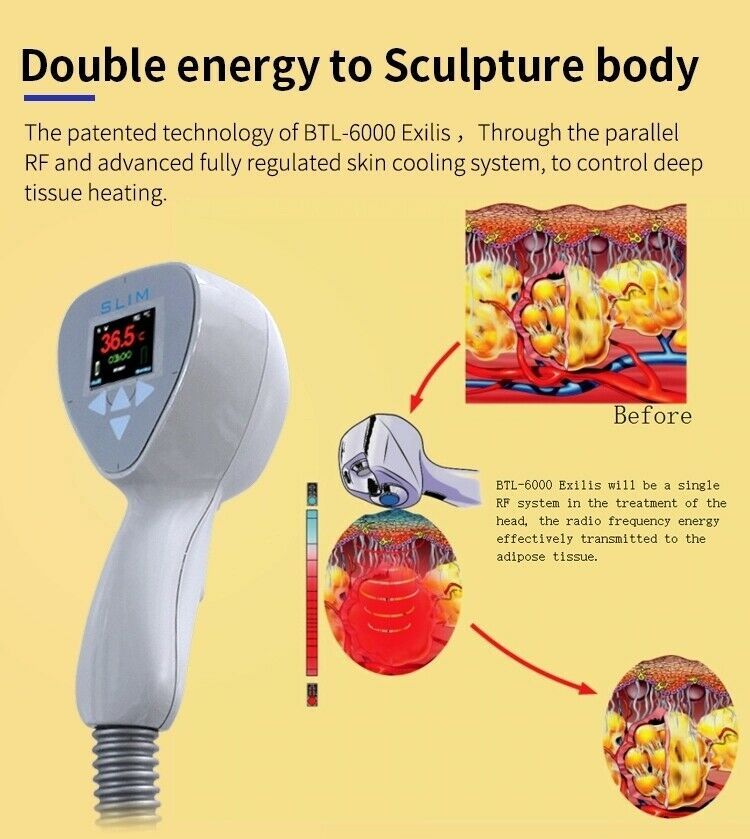 Portable 2 In 1 BTL Magic Ultrasound RF Skin Tighten Fat Removal Anti Cellulite Sculpting Beauty Machine Fat Reducing Weight Loss