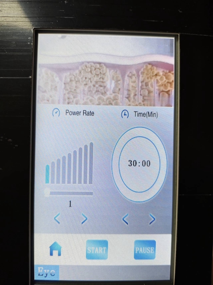 2in1 Anti-wrinkle Eyes Lifting Popular Product Magic Eye RF Energy Eyes Care Removing Eye Bags RF Face Skin Tightening Beauty Machine