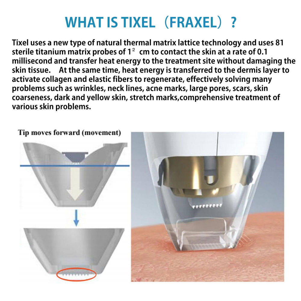 Tixel 400℃ Natural Thermal Fractional Skin Tightening Face Lifting Stretch Marks Removal Skin Care Rejuvenation