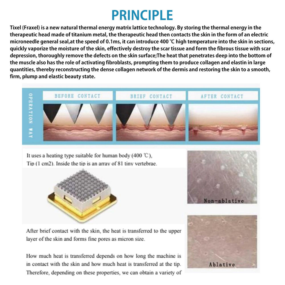 Tixel 400℃ Natural Thermal Fractional Skin Tightening Face Lifting Stretch Marks Removal Skin Care Rejuvenation
