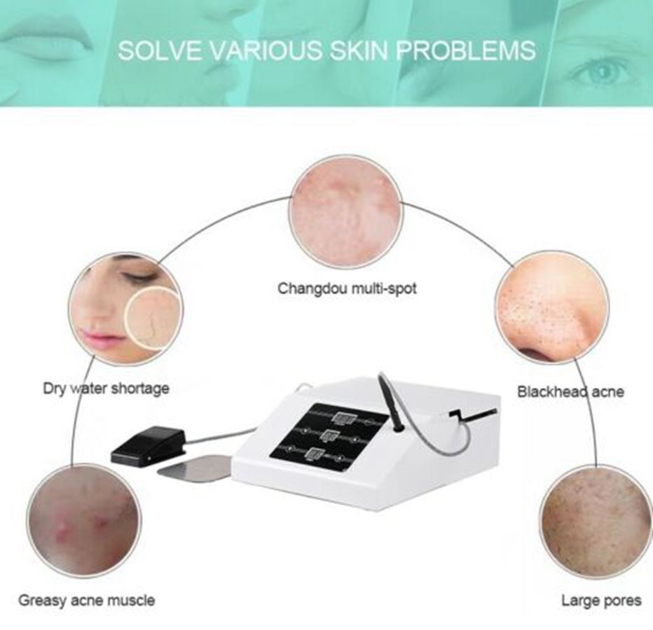 Korea Technology Acacia Acne Treatment Device Professional Acne Removal RF Machine