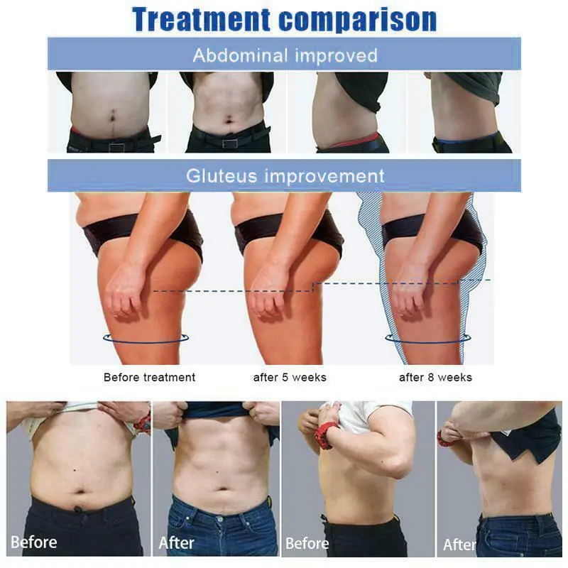 Emslim Neo Fat Burner Machine Muscle Stimulator Electromagnetic Body Sculpting and Contouring Machine