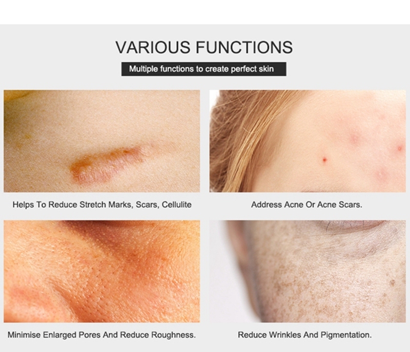 Price for 5pcs Aqua Micro Channel Needle 20 Hydra Gold Needle Fine Touch Skin Care Rejuvenation