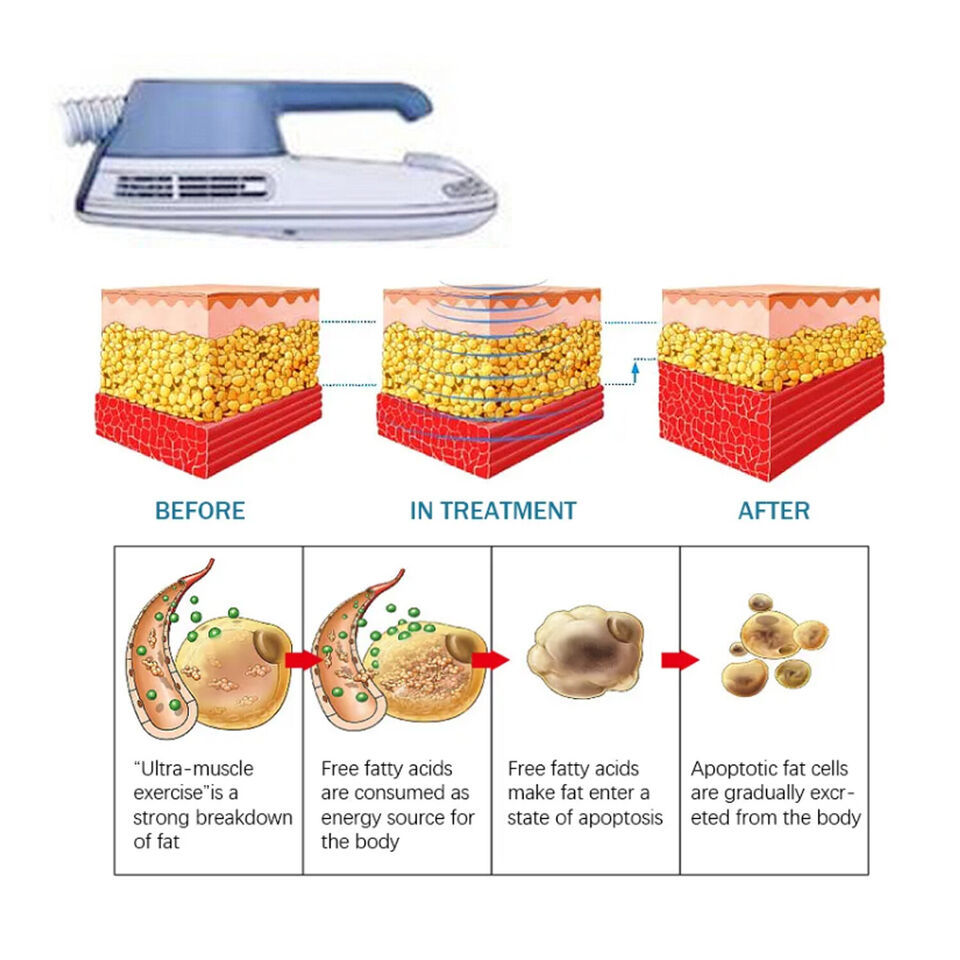 2in1 Electromagnetic Em Body Slim + Fat Freezing Cryo Therapy Lipolysis Machine