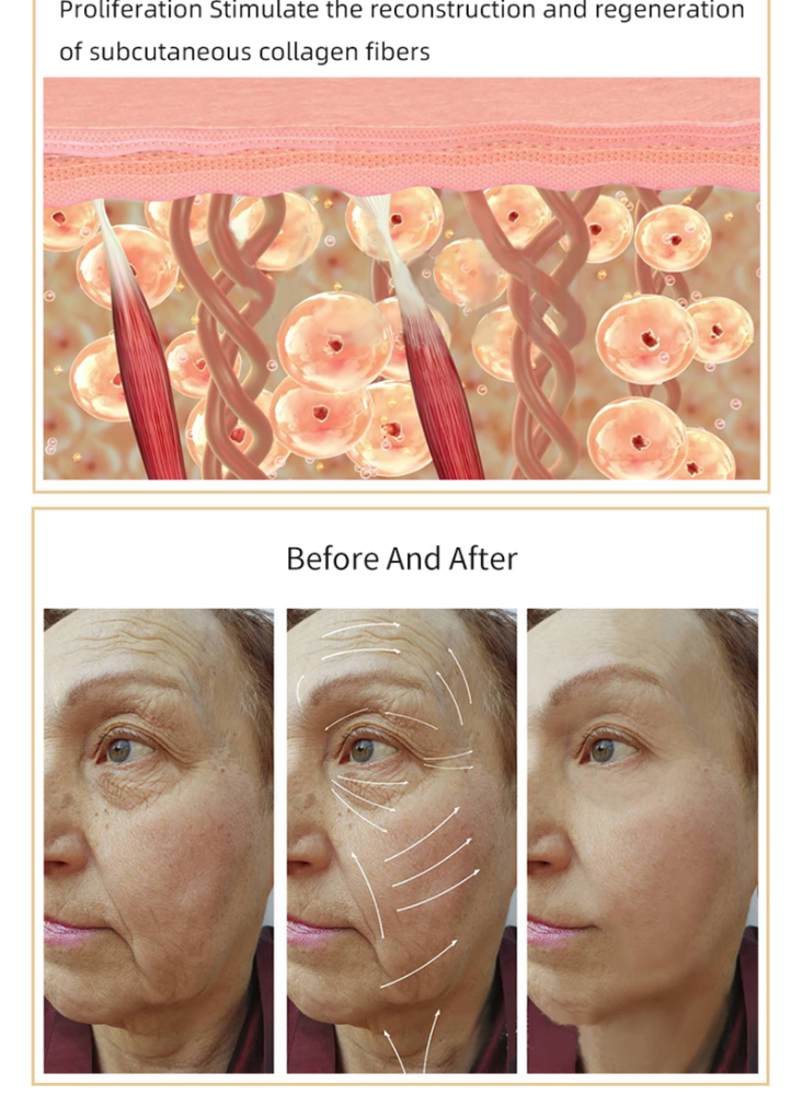 Newest Portable Fractional RF Thermage Machine Radio Frequency Face Skin Lifting Tighten