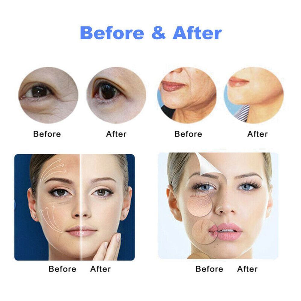 2in1 Portable High Intensity Focused Ultrasound HIFU Face Body Vaginal Tightening Machine Skin Lifting Wrinkle Removal