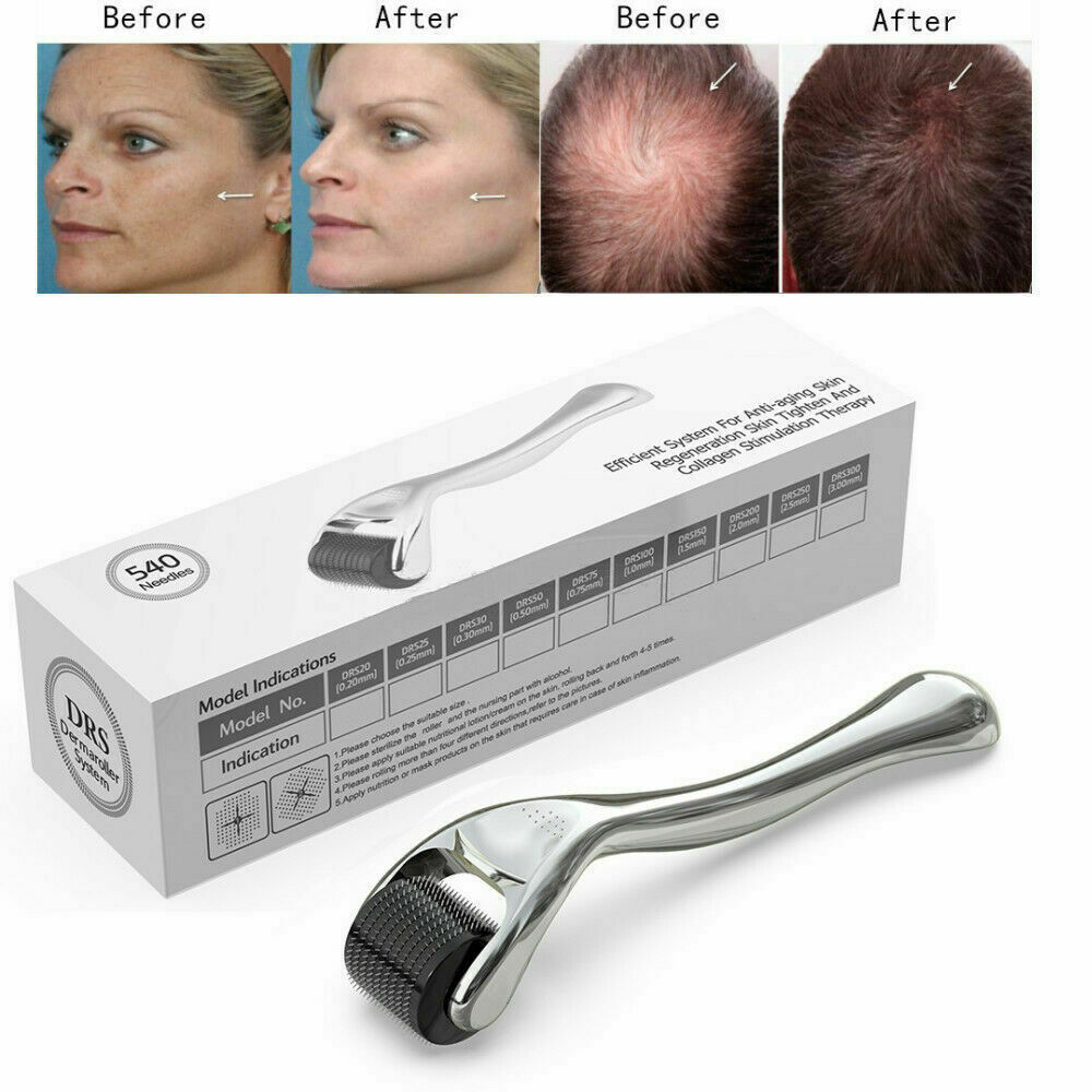 50pcs 0.3mm+50pcs 0.75mm 540 Stainless Steel Micro Derma Roller For Acne Scars Wrinkles,Beard, Hair Loss