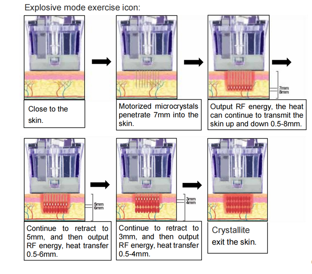 2in1 Single Point ICE Vmax Morpheus M8 Freezing Machine Face Skin Lifting Body Tighten Body Shape for Beauty Salon