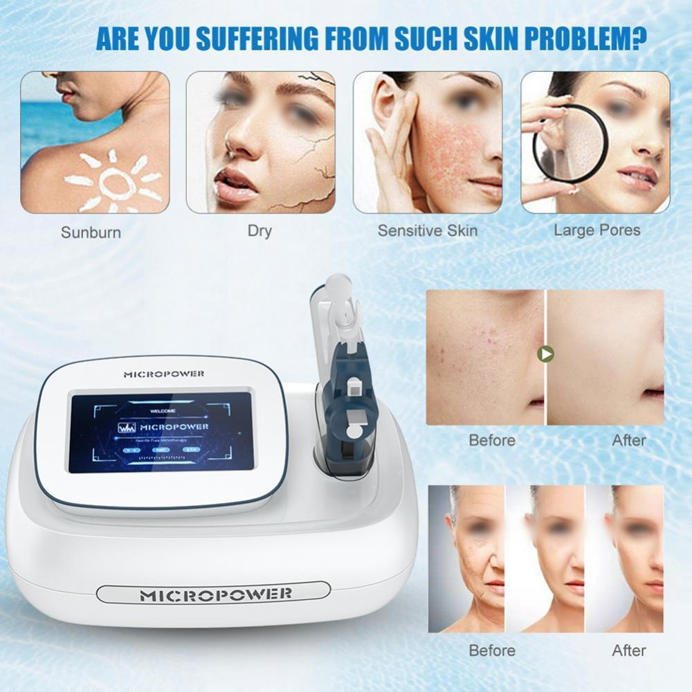 Professional Vanadium Titanium RF Mesotherapy Gun Microcrystalline Mesogun Painless Skin Injection Anti-aging for Eyes Face