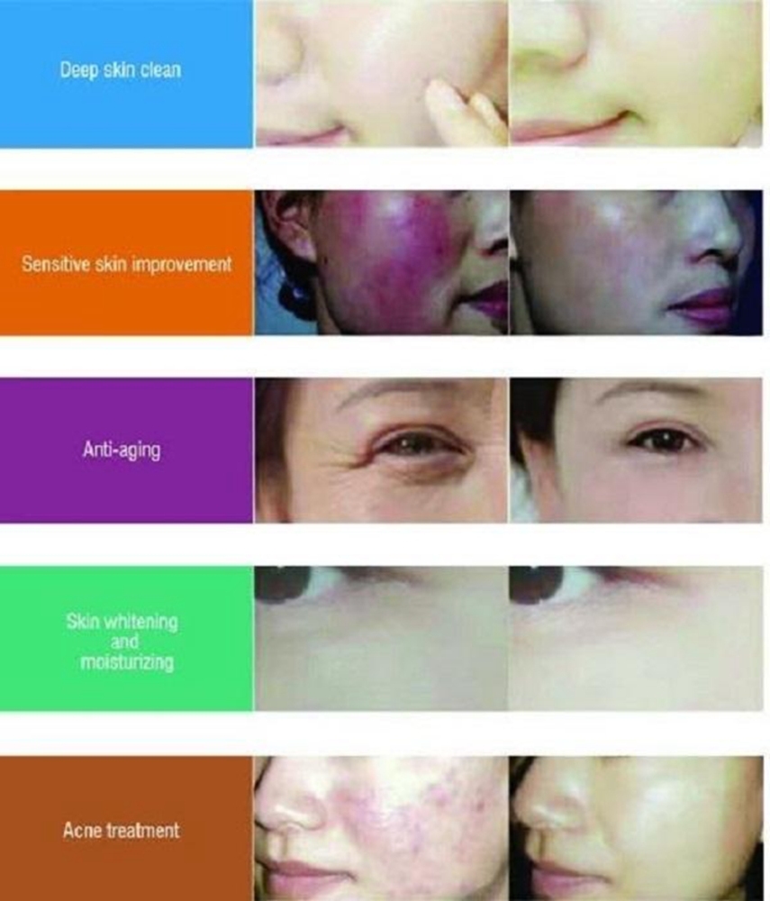 Smart Ice Blue 7-in-1 Magic Dermabrasion Mirror Deep Cleansing Instrument Professional Ultrasonic Skin Analysis Beauty Salon