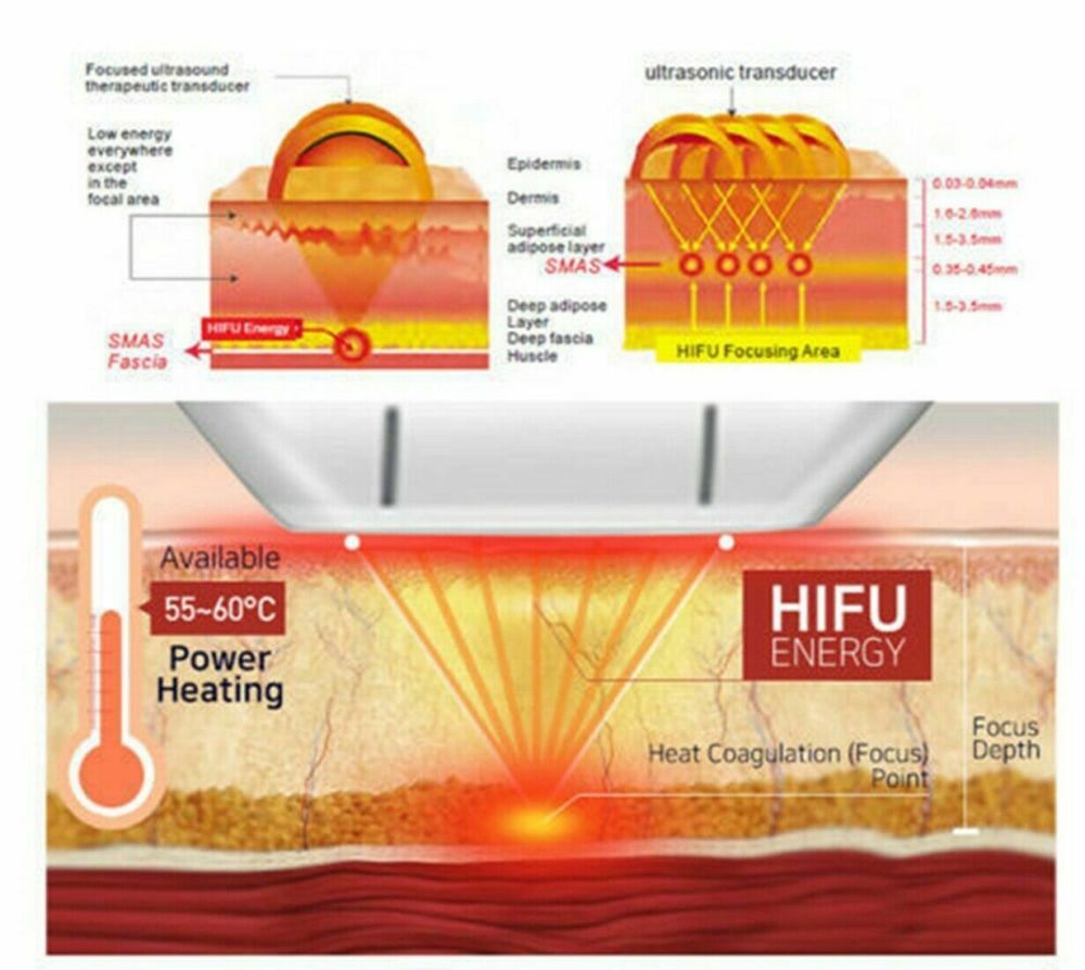 USA Stock! HIFU Machine Ultrasound Face 10000 Shots Exchangeable Facial Body Vaginal Cartridge/Anti Aging HIFU Transducer