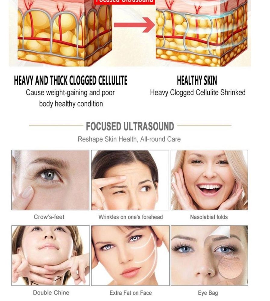 Radar Line Carve V Face Skin Rejuvenation Wrinkle Removal Beauty Machine