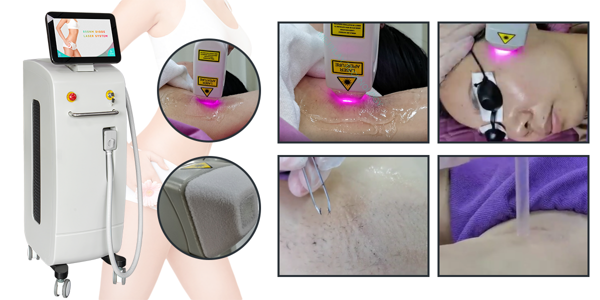 What can we do after laser treatment?