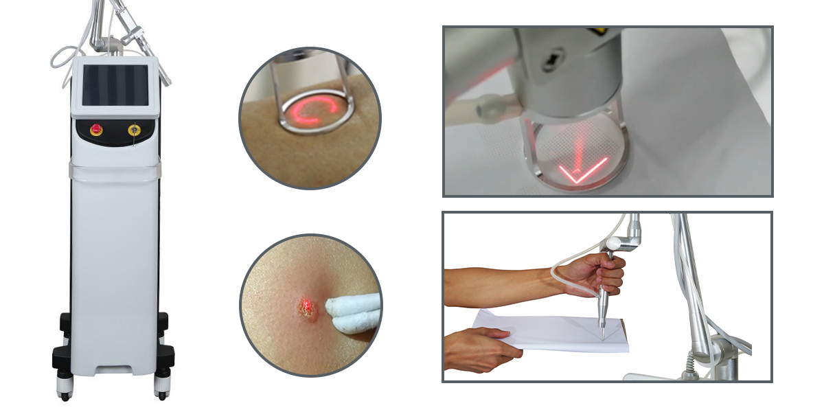Unlocking Beauty Potential: Laser Fractional CO2 Technology Explained