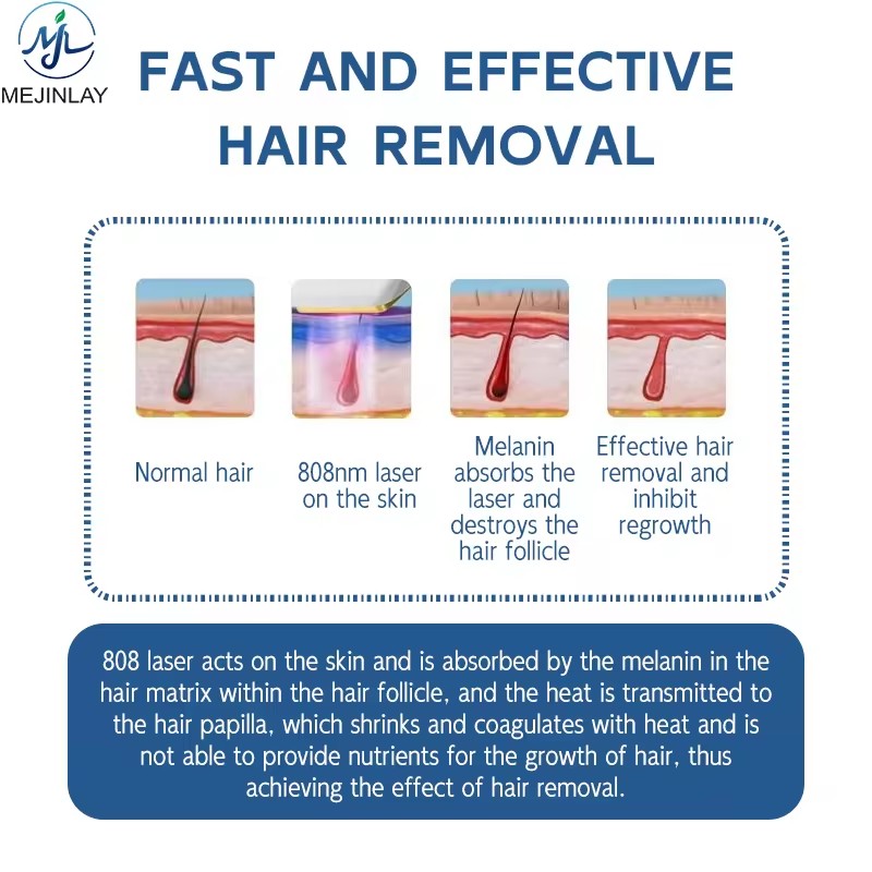 Portable laser hair removal machine for salon use