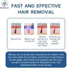 Portable laser hair removal machine for salon use