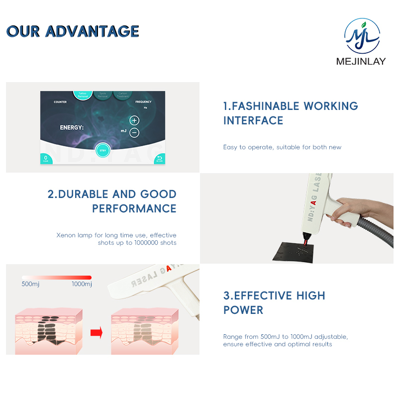 Q switch nd yag laser tattoo removal for skin care