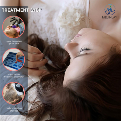 Q switch nd yag laser tattoo removal for skin care