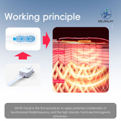 EM face Pulse Magnetic Facial Lifting Thermal anti-aging equipment