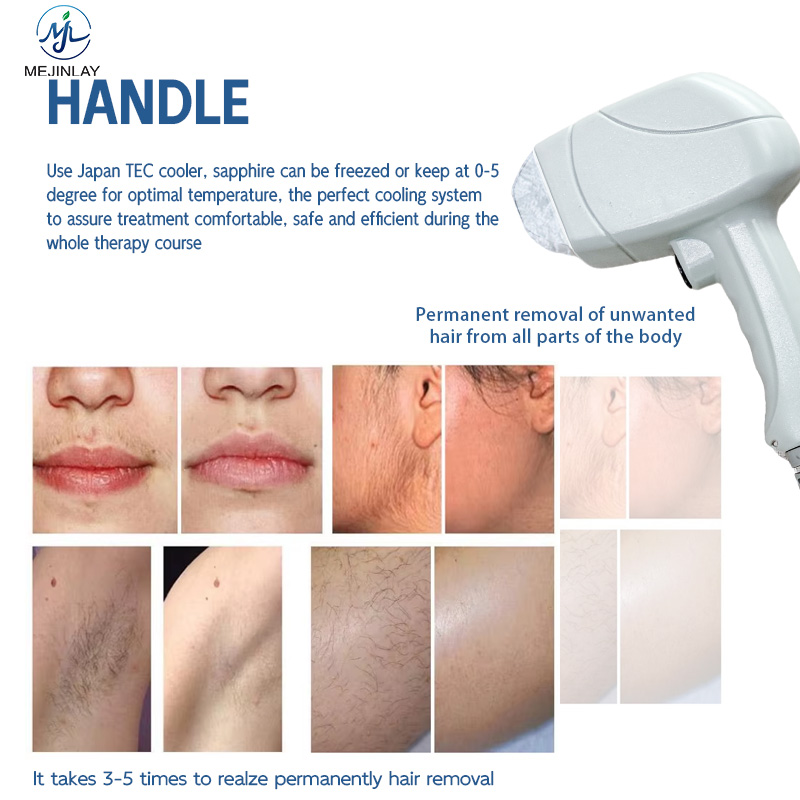 DL203 Painless 808 Laser Permanent Hair Removal Device