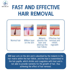 DL203 Painless 808 Laser Permanent Hair Removal Device