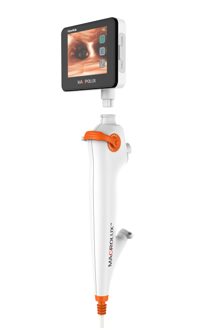 B series Single-Use Digital Flexible Bronchoscope