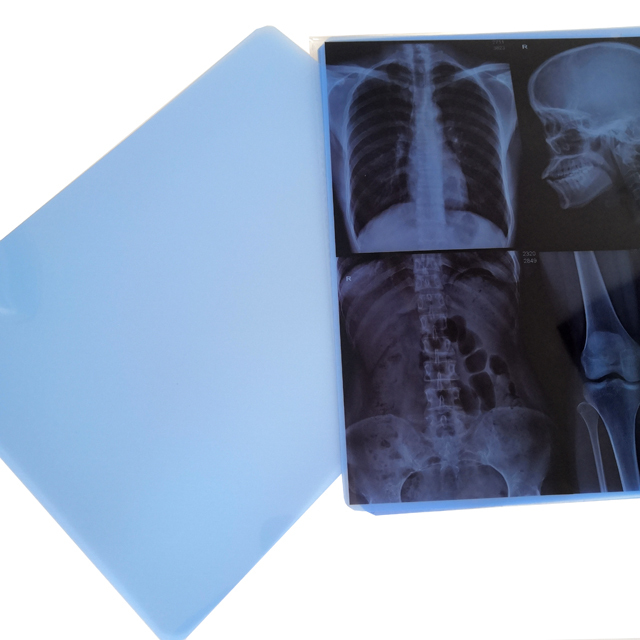 Medical Blue PET Inkjet Film