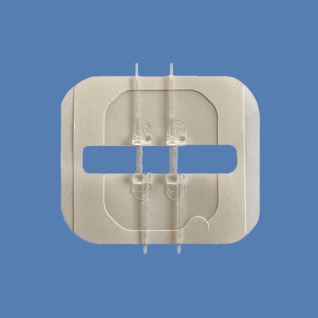 Hautklammergeräte / Wundverschlussgerät