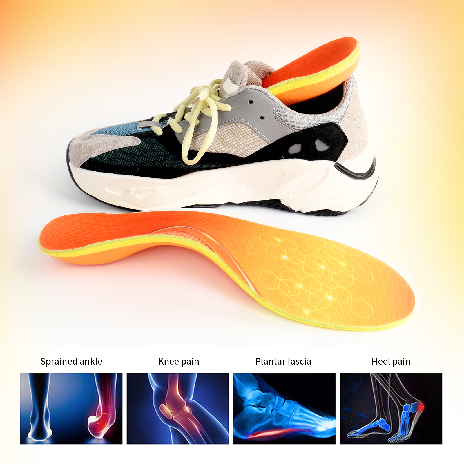 Arch Support