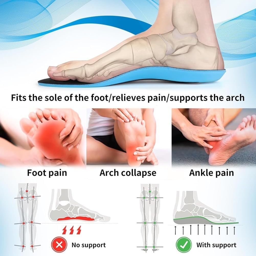 Arch support