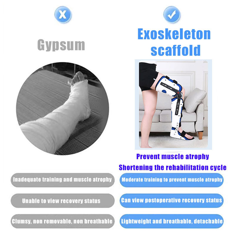 Knee fixed support