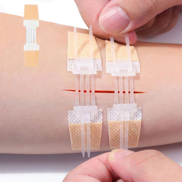 Wundverschlussgerät/Hautklammergeräte