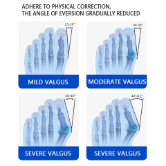 Ballenzehen-Korrektor