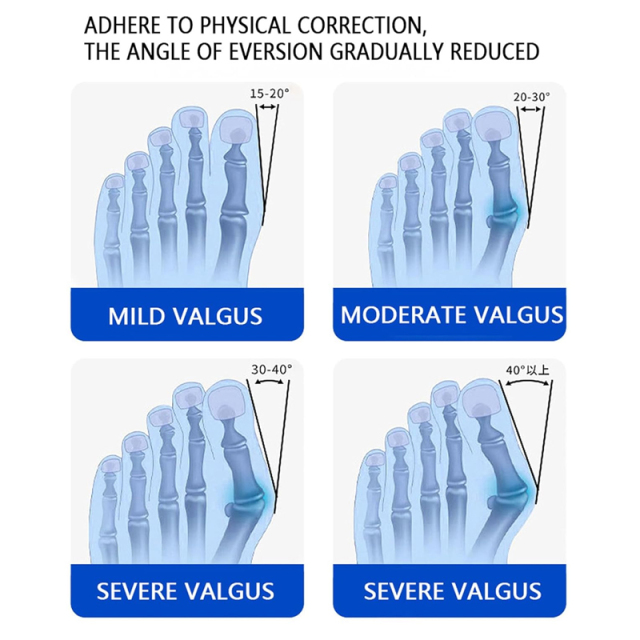 Ballenzehen-Korrektor