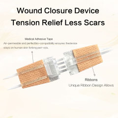 Wundverschlussgerät/Hautklammergeräte