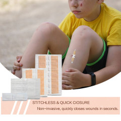 Wundverschlussgerät/Hautklammergeräte